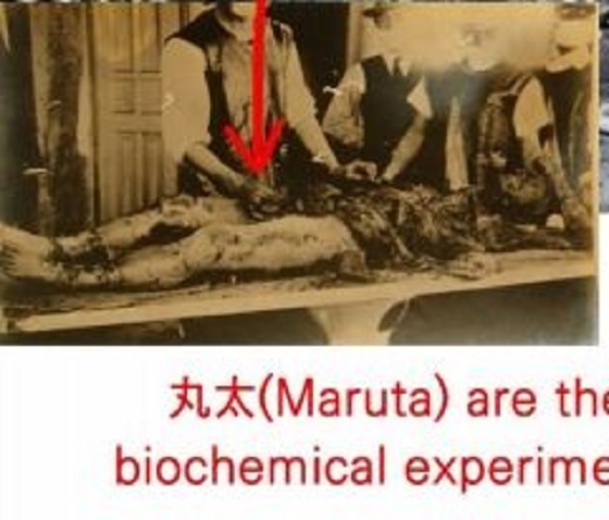 20200206反日「志賀丸太は人体実験被験者をマルタと呼んだ史実を連想させる」→集英社と堀越耕平が名前変更