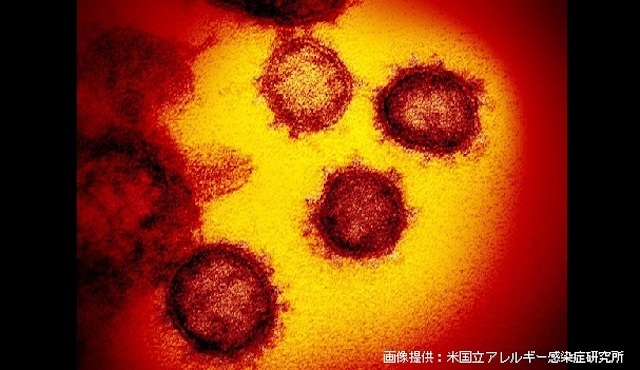 20200304 新型コロナウイルス